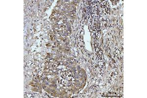 IHC analysis of Glutaminase/GLS using anti-Glutaminase/GLS antibody (ABIN7601602).