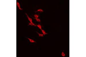 ABIN6274238 staining NIH-3T3 by IF/ICC. (Recoverin 抗体  (Internal Region))