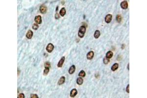 Used in DAB staining on fromalin fixed paraffin-embedded Brain tissue (EBF2 抗体  (AA 285-536))
