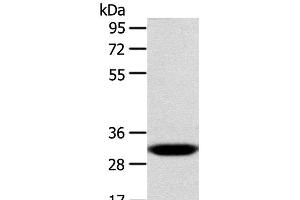 Western Blot analysis of Human fetal liver tissue using CCS Polyclonal Antibody at dilution of 1:300 (Superoxide dismutase copper chaperone 抗体)