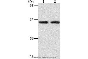 Western blot analysis of Human liver cancer and fetal kidney tissue, using ACOT11 Polyclonal Antibody at dilution of 1:650 (ACOT11 抗体)