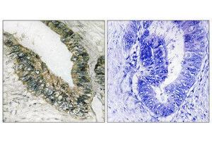 Immunohistochemistry (IHC) image for anti-Eukaryotic Translation Initiation Factor 2-alpha Kinase 3 (EIF2AK3) (Thr981) antibody (ABIN1848259) (PERK 抗体  (Thr981))