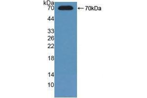 Western blot analysis of recombinant Mouse ADK. (ADK 抗体  (AA 1-361))