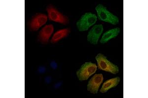 ABIN7093938 and ABIN7097982 staining Hela cells by IF/ICC.