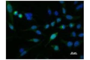 Immunostaining analysis in HeLa cells. (KIF2C 抗体)