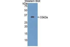 Western blot analysis of the recombinant protein. (ECE1 抗体  (AA 469-721))