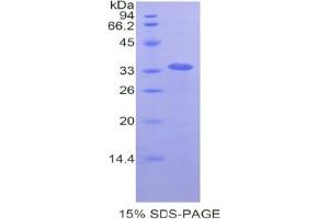 SDS-PAGE analysis of Human LOXL4 Protein. (LOXL4 蛋白)