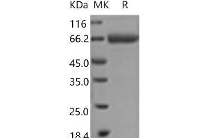 Western Blotting (WB) image for Bone Marrow Stromal Cell Antigen 1 (BST1) protein (Fc Tag) (ABIN7321111) (BST1 Protein (Fc Tag))