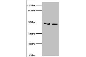 Western blot All lanes: Histone-lysine N-methyltransferase SMYD3 antibody at 3 μg/mL Lane 1: Hela whole cell lysate Lane 2: HepG2 whole cell lysate Secondary Goat polyclonal to rabbit IgG at 1/10000 dilution Predicted band size: 50, 30, 43 kDa Observed band size: 50 kDa (SMYD3 抗体  (AA 199-428))