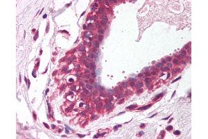 Anti-ETV4 / PEA3 antibody IHC of human breast. (ETV4 抗体  (AA 181-230))
