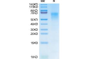 Cynomolgus CD19 on Tris-Bis PAGE under reduced condition. (CD19 Protein (AA 21-291) (His tag))