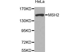 Western blot analysis of extracts of HeLa cell line, using MSH2 antibody. (MSH2 抗体)