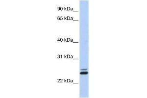 JAZF1 antibody used at 0. (JAZF1 抗体  (N-Term))