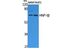 Western Blotting (WB) image for anti-HNF1 Homeobox B (HNF1B) (N-Term) antibody (ABIN3187643) (HNF1B 抗体  (N-Term))