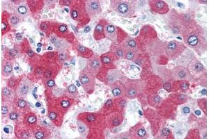 Human Liver (formalin-fixed, paraffin-embedded) stained with FTCD antibody ABIN351476 at 3. (FTCD 抗体  (AA 2-17))