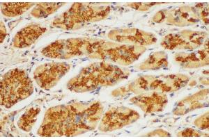 Immunohistochemistry of paraffin-embedded Human stomach using ST14 Ployclonal Antibody at dilution of 1:100. (ST14 抗体)