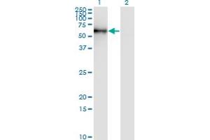 Western Blot analysis of STK33 expression in transfected 293T cell line by STK33 monoclonal antibody (M06), clone 4F7. (STK33 抗体  (AA 1-514))