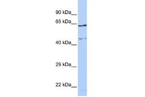 WB Suggested Anti-CCDC74A Antibody Titration: 0.