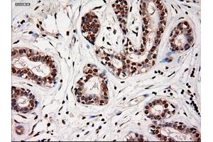 Immunohistochemical staining of paraffin-embedded breast using anti-NTF4 (ABIN2452547) mouse monoclonal antibody. (Neurotrophin 4 抗体  (AA 81-210))