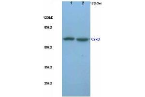 L1 rat lung lysates, L2 rat brain lysates probed (ABIN681853) Anti-Frizzled-5 Polyclonal, Unconjugated at 1:200 in 4 °C. (Frizzled5/8 抗体  (AA 51-150))