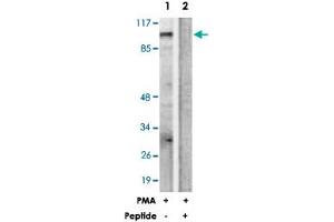 Western blot analysis of extracts from HUVEC cells, treated with PMA (125 ng/mL, 30 mins), using PRKD1 polyclonal antibody . (PKC mu 抗体  (Ser205))