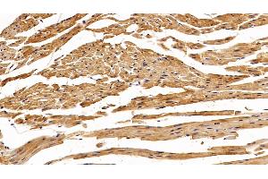 Detection of SOD1 in Mouse Cardiac Muscle Tissue using Polyclonal Antibody to Superoxide Dismutase 1 (SOD1) (SOD1 抗体  (AA 2-154))