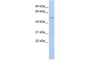 WB Suggested Anti-CECR6 Antibody Titration:  0. (CECR6 抗体  (Middle Region))