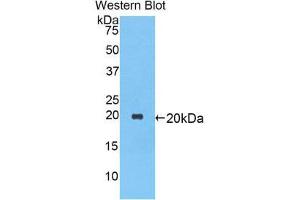 Western Blotting (WB) image for anti-serpin Peptidase Inhibitor, Clade A (Alpha-1 Antiproteinase, Antitrypsin), Member 1 (SERPINA1) (AA 27-181) antibody (ABIN1077773) (SERPINA1 抗体  (AA 27-181))