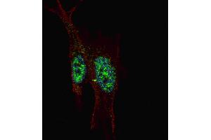 Immunofluorescence (IF) image for anti-Signal Transducer and Activator of Transcription 3 (Acute-Phase Response Factor) (STAT3) (AA 711-743), (C-Term) antibody (ABIN1537683)