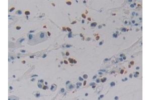 Immunohistochemistry (IHC) image for anti-Defensin, alpha 4, Corticostatin (DEFA4) (AA 23-97) antibody (ABIN7441130)