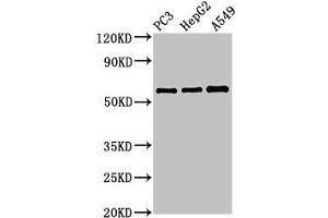 Western Blot Positive WB detected in: PC-3 whole cell lysate, HepG2 whole cell lysate, A549 whole cell lysate All lanes: vnn1 antibody at 3. (VNN1 抗体  (AA 97-197))