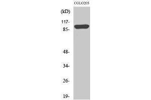 Western Blotting (WB) image for anti-Proteasome (Prosome, Macropain) 26S Subunit, Non-ATPase, 2 (PSMD2) (N-Term) antibody (ABIN3177038) (PSMD2 抗体  (N-Term))