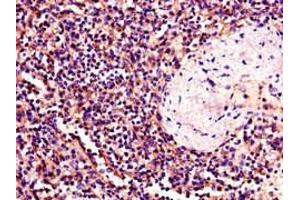 Immunohistochemistry of paraffin-embedded human spleen tissue using ABIN7174011 at dilution of 1:100 (BTK 抗体  (AA 254-443))