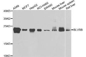 Western blot analysis of extracts of various cell lines, using BLVRB antibody (ABIN5975104) at 1/1000 dilution. (BLVRB 抗体)