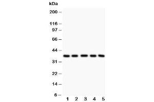 Western blot testing of LOX-1 antibody and Lane 1:  rat liver (OLR1 抗体  (Middle Region))