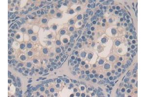 DAB staining on IHC-P; Samples: Mouse Testis Tissue (STAMBP 抗体  (AA 166-406))