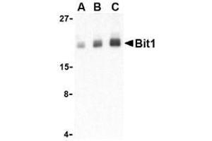 Western blot analysis of Bit1 in Daudi cell lysate with AP30153PU-N Bit1 antibody at (A) 1, (B) 2, and (C) 4 μg/ml. (PTRH2 抗体  (Middle Region))