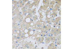 Immunohistochemistry of paraffin-embedded human liver injury using CHMP1B antibody (ABIN5974811) at dilution of 1/100 (40x lens). (CHMP1B 抗体)