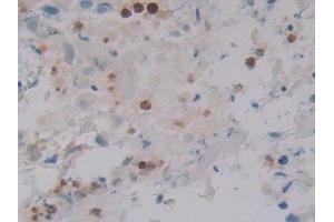 Immunohistochemistry (IHC) image for anti-Defensin, alpha 4, Corticostatin (DEFA4) (AA 23-97) antibody (ABIN7441130)