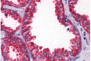 Immunohistochemistry (Formalin-fixed Paraffin-embedded Sections) (IHC (fp)) image for anti-Coronin, Actin Binding Protein, 1B (CORO1B) (AA 1-490) antibody (ABIN574458)