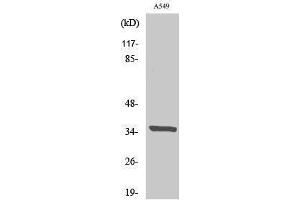 Western Blotting (WB) image for anti-Peroxisomal Biogenesis Factor 2 (PEX2) (N-Term) antibody (ABIN3176842) (PEX2 抗体  (N-Term))