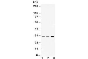 Western blot testing of 1) rat testis, 2) mouse spleen and 3) human HepG2 lysate with PSMA1 antibody at 0.