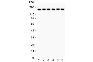 Western blot testing of PAPP-A antibody and human samples 1:  placenta (PAPPA 抗体  (AA 95-388))