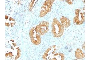 IHC testing of FFPE human rectum tissue with Villin antibody (clone VIL1/1314). (Villin 1 抗体  (AA 179-311))