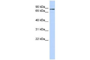 WB Suggested Anti-ZNF366 Antibody Titration:  0. (ZNF366 抗体  (C-Term))