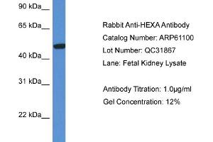 Western Blotting (WB) image for anti-Hexosaminidase A (HEXA) (C-Term) antibody (ABIN2788673) (Hexosaminidase A 抗体  (C-Term))