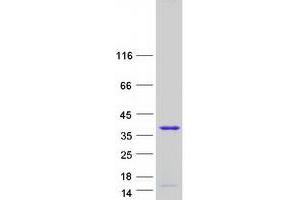 Transcription Elongation Factor A (SII)-Like 3 (TCEAL3) (Transcript Variant 2) protein (Myc-DYKDDDDK Tag)