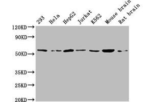 Western Blot Positive WB detected in: 293 whole cell lysate, Hela whole cell lysate, HepG2 whole cell lysate, Jurkat whole cell lysate, K562 whole cell lysate, Mouse brain tissue, Rat brain tissue All lanes: ATP5A1 antibody at 1:2000 Secondary Goat polyclonal to rabbit IgG at 1/50000 dilution Predicted band size: 60, 55, 58 kDa Observed band size: 60 kDa (ATP5F1A (AA 59-257) 抗体)