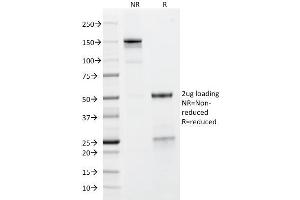 SDS-PAGE Analysis Purified GP2 Mouse Monoclonal Antibody (GP2/1712). (GP2 抗体  (AA 35-179))