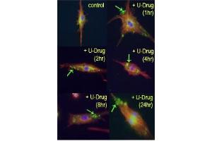 Time course study of mouse leukaemic monocyte macrophage cells treated with U18666A, a drug that causes cholesterol and lipid storage in cells, thereby blocking fusion between late endosomes and lysosomes. (LC3B 抗体  (cleaved))